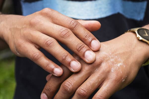 Primal Derma Hand